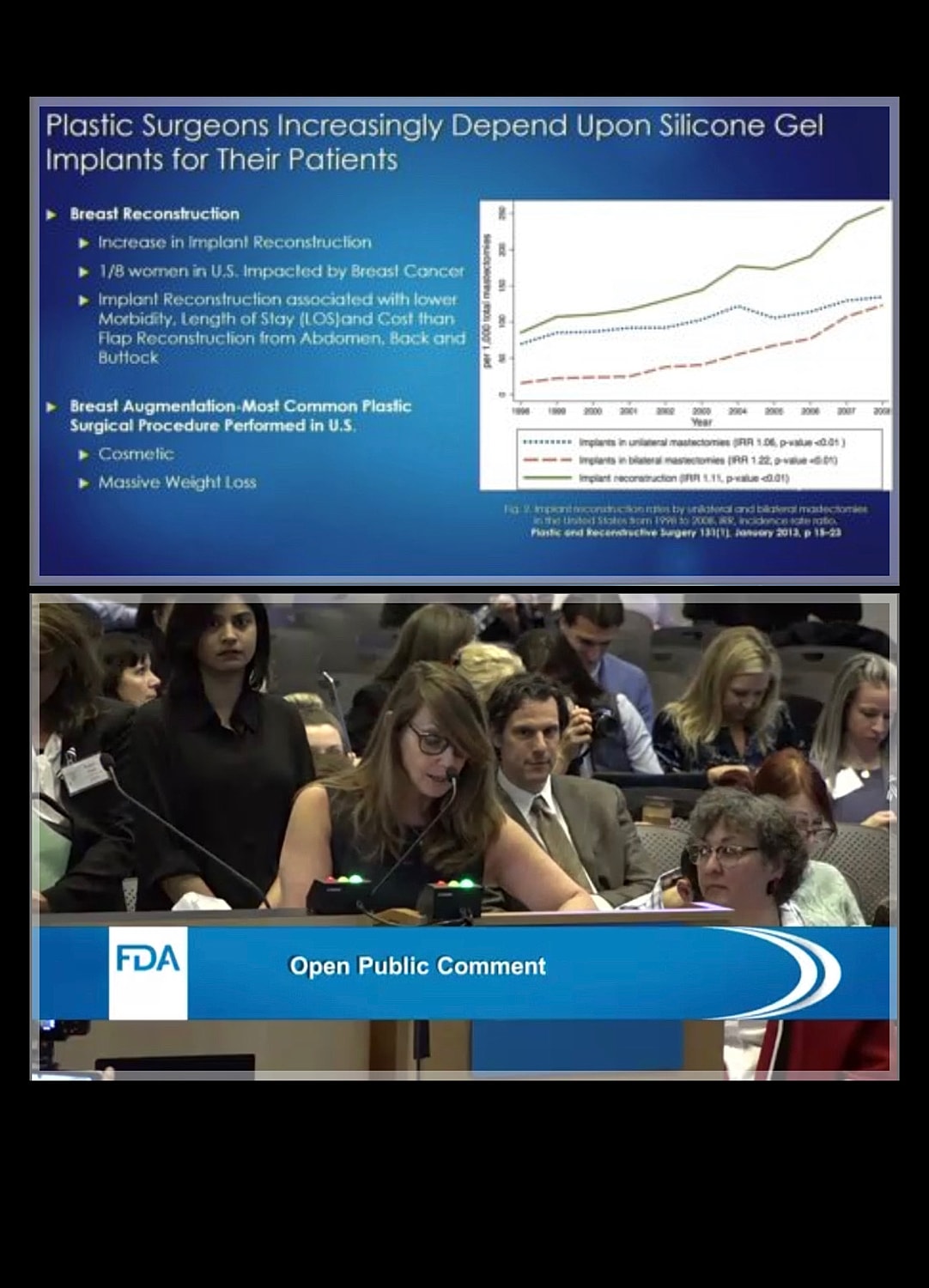 Public comment on silicone gel implants and surgery.
