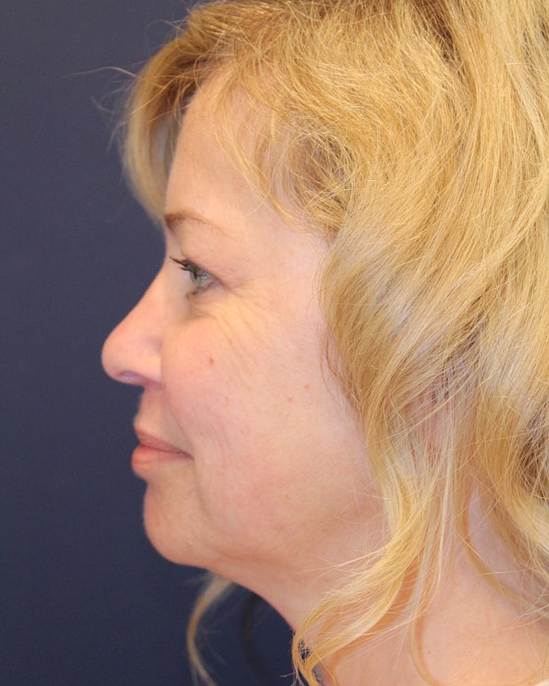 Profile view of a woman with blonde hair.