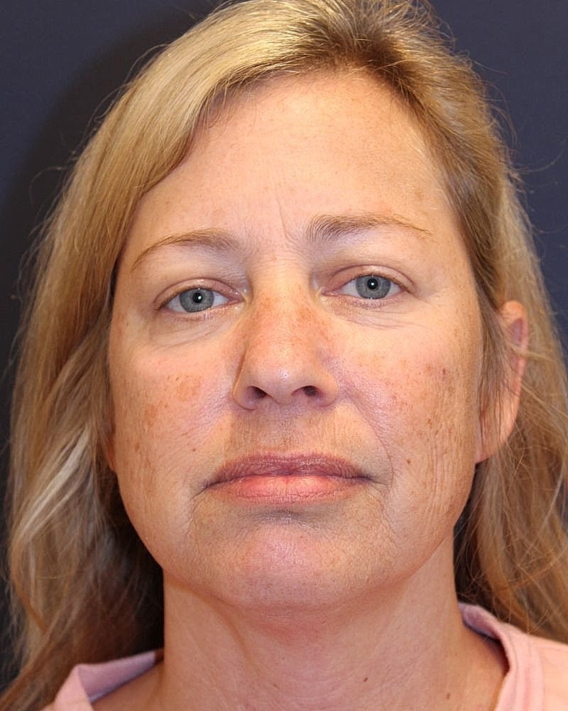 Woman with light brown hair and neutral expression.