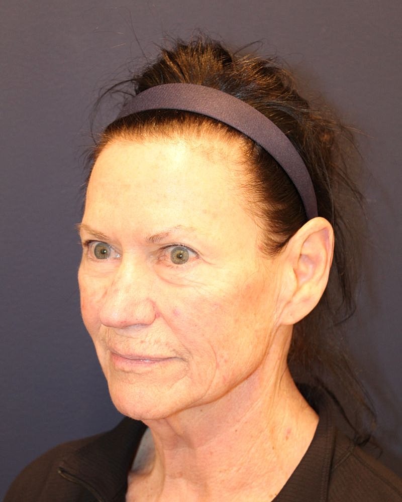 Woman with headband, neutral expression, profile view.