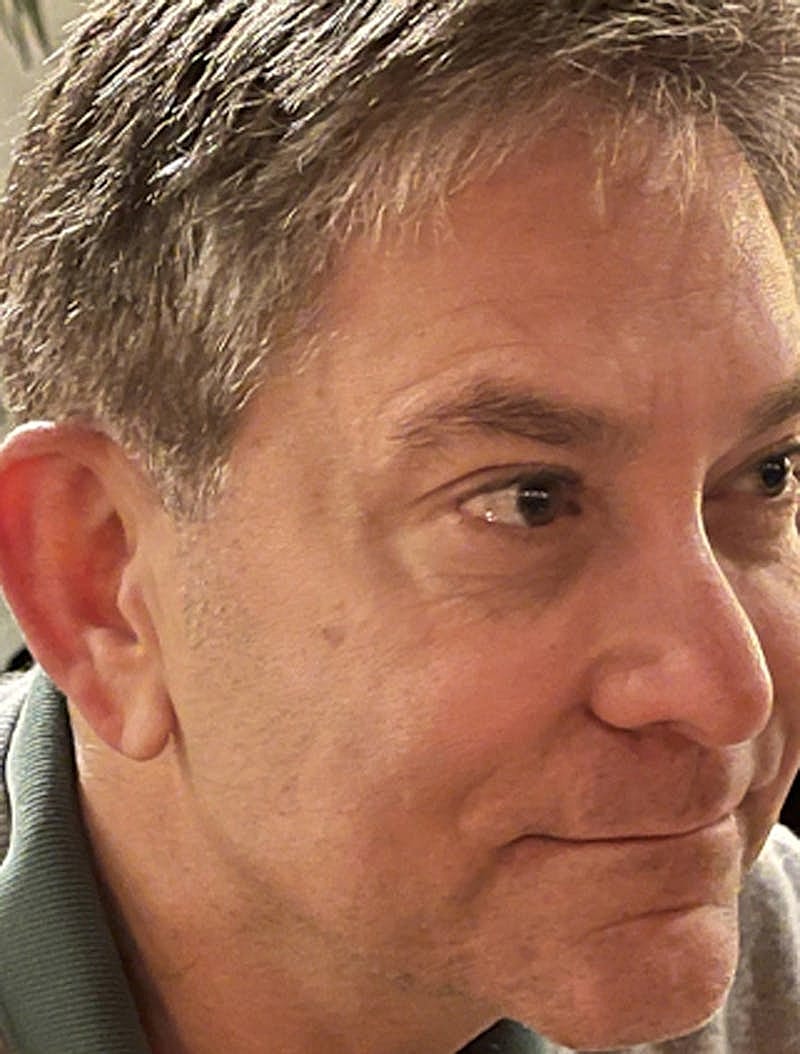 Botox Dysport Before & After