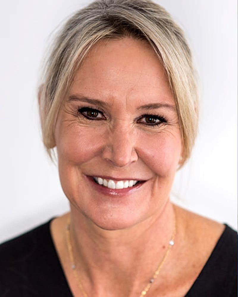 Botox Dysport Before & After