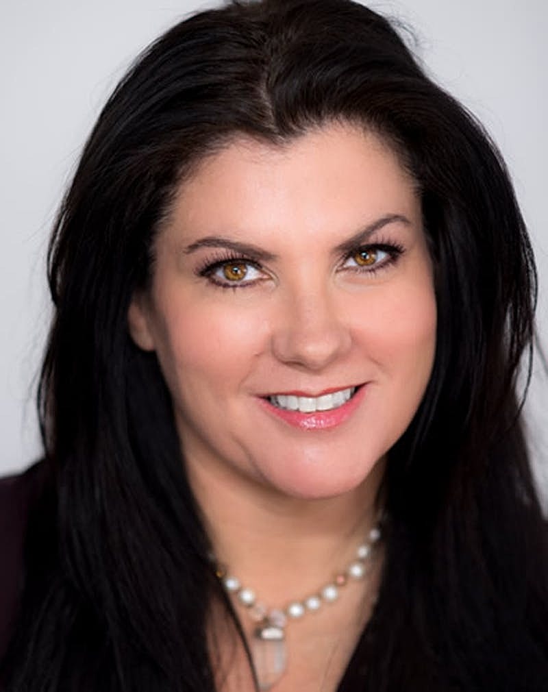 Botox Dysport Before & After