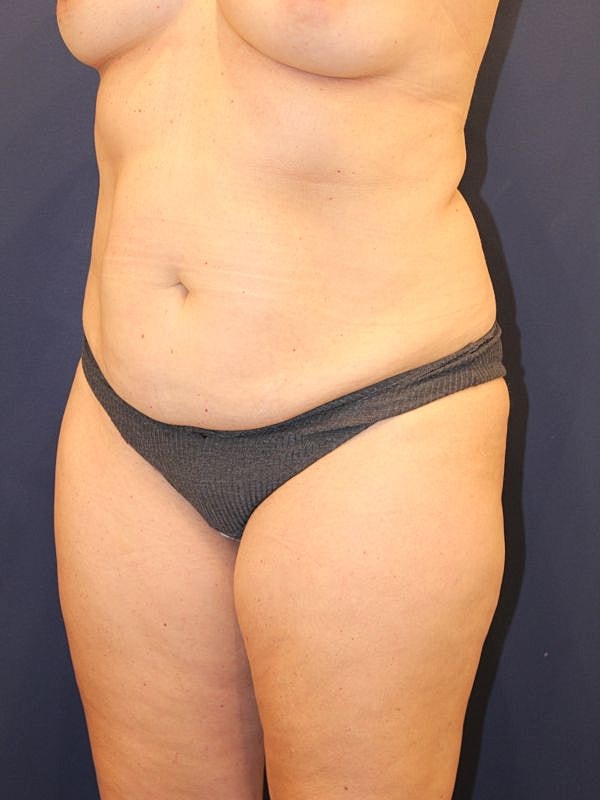 Side view of a person in swimwear.