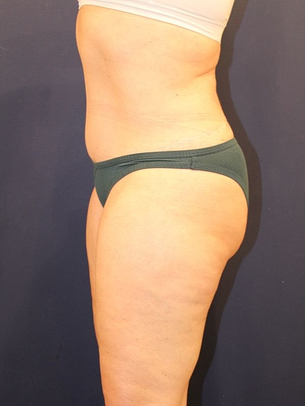 Side profile of a person in underwear.