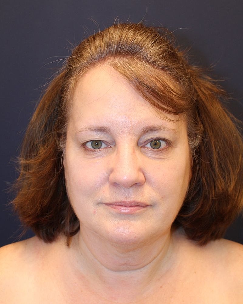 Woman with medium-length brown hair, neutral expression.