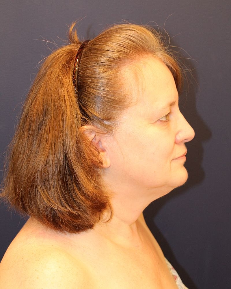 Profile view of a woman with shoulder-length hair.