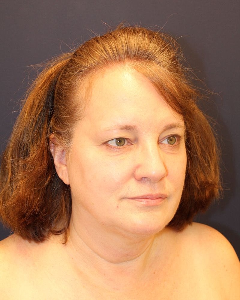 Woman with shoulder-length hair, neutral expression.