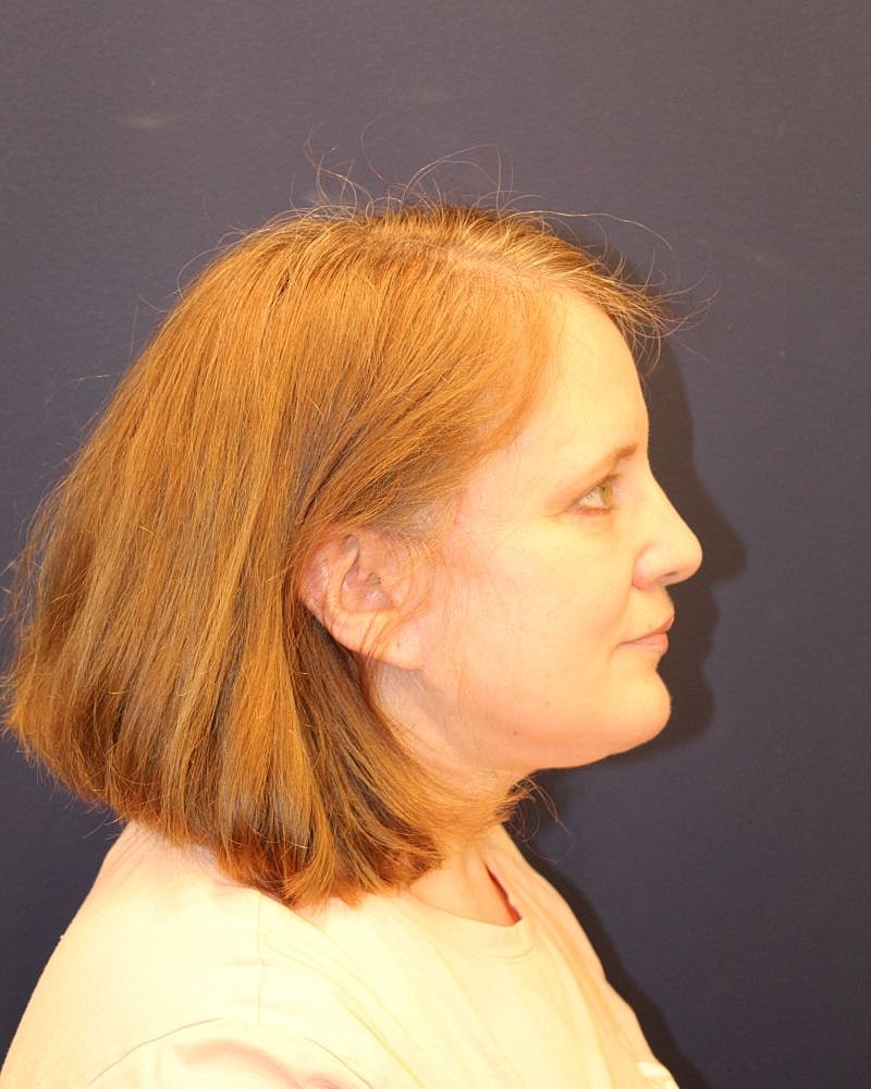 Profile view of a woman with shoulder-length hair.