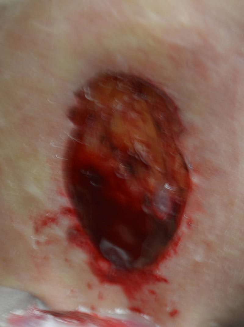 Complex Facial Reconstruction Cancer Trauma Before & After