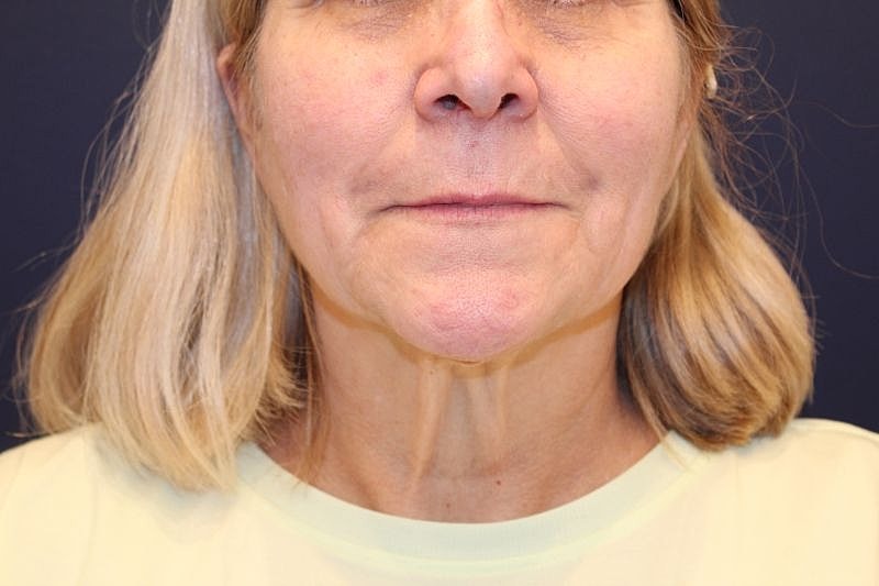 Close-up of woman with short blonde hair.
