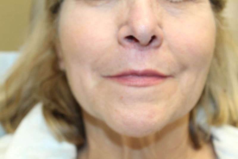 Woman's close-up face, neutral expression, indoor setting.