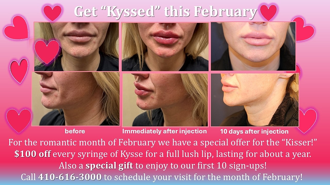 Kysse lip transformation before and after images.